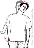 Nervenmobilisation