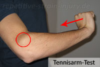 Tennisarm